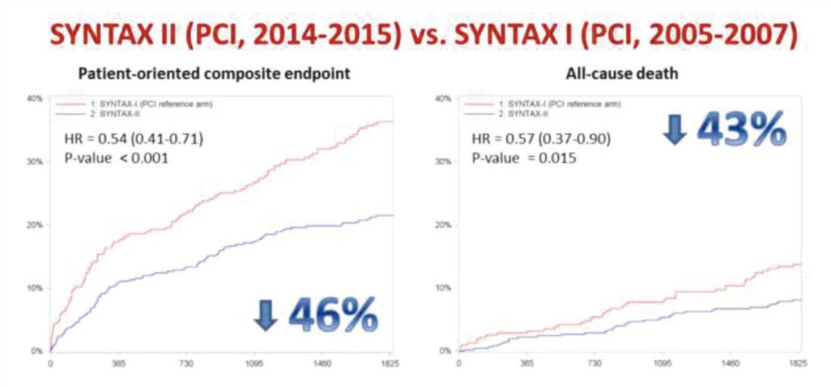 Javier Escaned (@jescaned) on Twitter photo SYNTAX II 5 year final results published online today bit.ly/3iEoZrO Key message: it is not only PCI developments, but their integration and use into a consistent strategy, what benefits complex PCI patients <a href="/PCRonline/">PCRonline 🫀</a> <a href="/IIS_IdISSC/">IdISSC, IIS del Hospital Clínico San Carlos</a> <a href="/CardioRed1/">CardioRed 1</a> <a href="/ehj_ed/">EHJ Editor-in-Chief</a> <a href="/TCTMD/">TCTMD</a> <a href="/shci_sec/">ACI-SEC: Hemodinamica</a> SYNTAX II 5 year final results published online today bit.ly/3iEoZrO Key message: it is not only PCI developments, but their integration and use into a consistent strategy, what benefits complex PCI patients <a href="/PCRonline/">PCRonline 🫀</a> <a href="/IIS_IdISSC/">IdISSC, IIS del Hospital Clínico San Carlos</a> <a href="/CardioRed1/">CardioRed 1</a> <a href="/ehj_ed/">EHJ Editor-in-Chief</a> <a href="/TCTMD/">TCTMD</a> <a href="/shci_sec/">ACI-SEC: Hemodinamica</a>