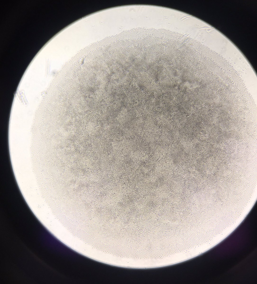 AmborInes's tweet photo. Interesting geometry of unstimulated PBMCs in a round-bottom well #immunology #humanitas #cancerimmunology https://t.co/oLdm3SvPwC