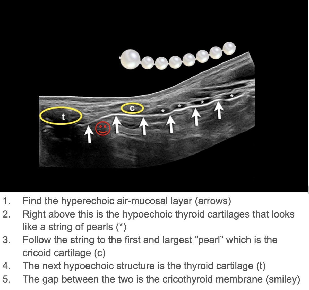 UT Southwestern EM Ultrasound tweet media