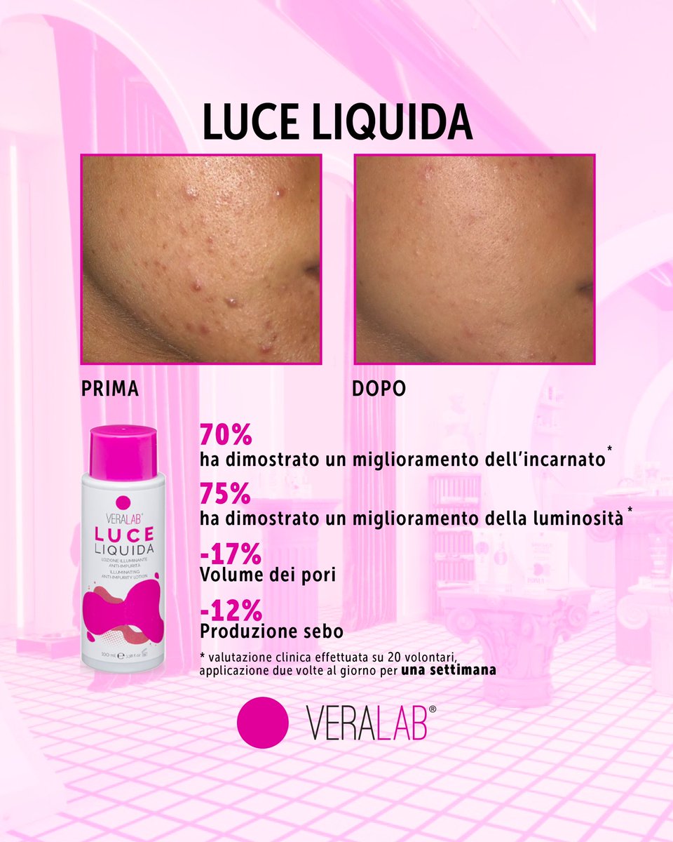 Veralab_cinica's tweet photo. Una fagiana ci ha mandato qualche giorno fa questi scatti in chat e noi abbiamo pensato: impaginiamoli subito e mostriamoli alla nostra famiglia fagiana!
Quello che vedete è il prima e dopo, con l’utilizzo di luce liquida 😍
#veralab #skincare #primaedopo #luceliquida https://t.co/IPjn1mnLHh