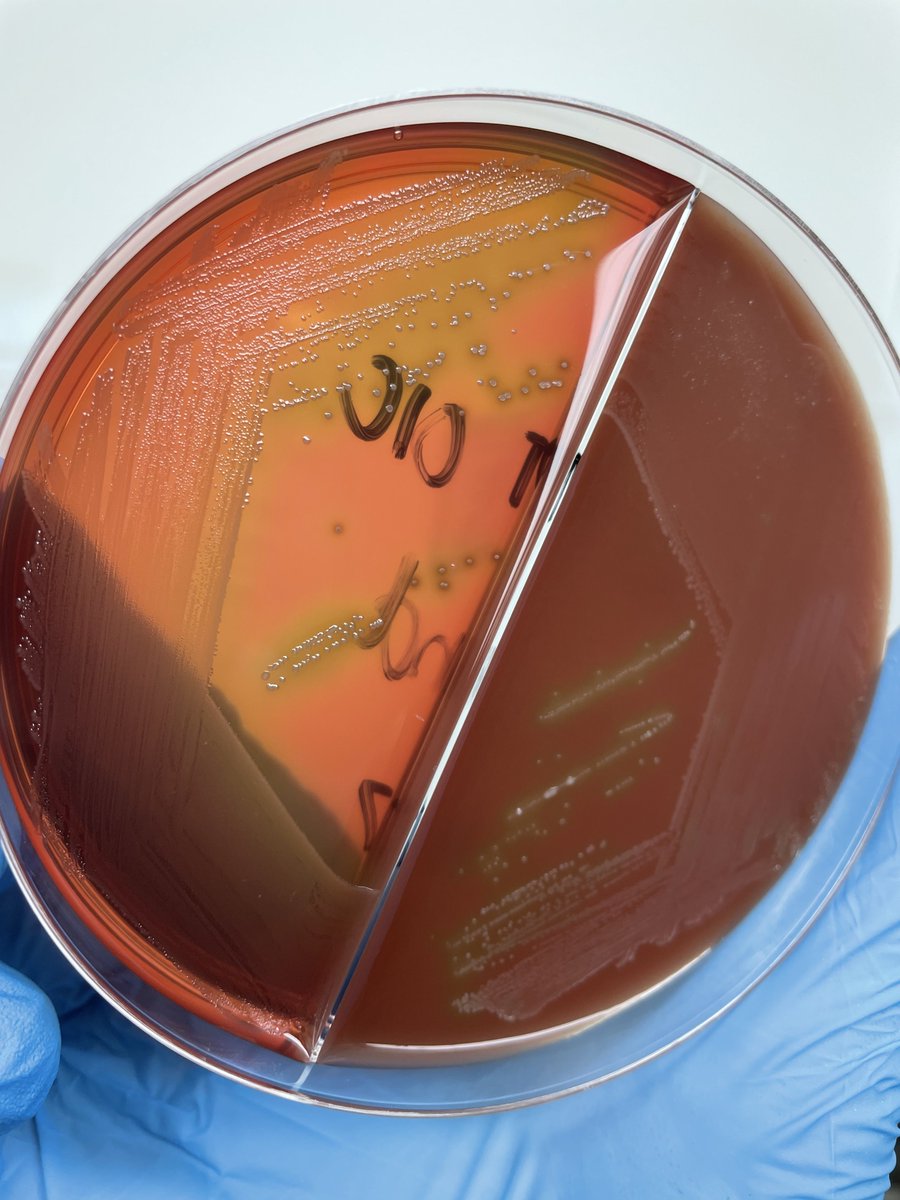 philipellorin_'s tweet photo. Alpha hemolysis on blood agar plate.  Notice the green discoloration in the medium. 
@MedtechMustKnow 
@medtech_journal https://t.co/YylbXbNv4j