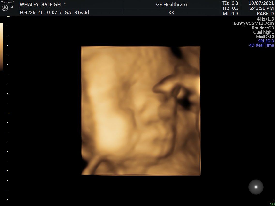 baleighwhaley's tweet photo. our sweet Tatum 💙 9 weeks (or less) until we meet him 🥰 https://t.co/4luUGjI74T