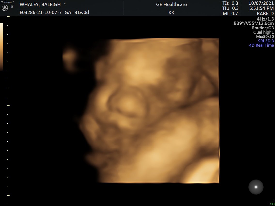 baleighwhaley's tweet photo. our sweet Tatum 💙 9 weeks (or less) until we meet him 🥰 https://t.co/4luUGjI74T