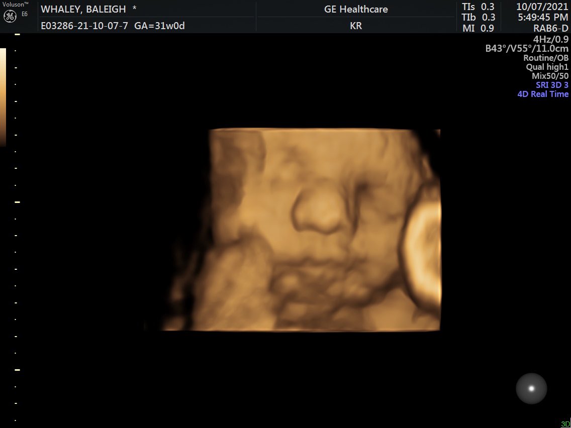 baleighwhaley's tweet photo. our sweet Tatum 💙 9 weeks (or less) until we meet him 🥰 https://t.co/4luUGjI74T