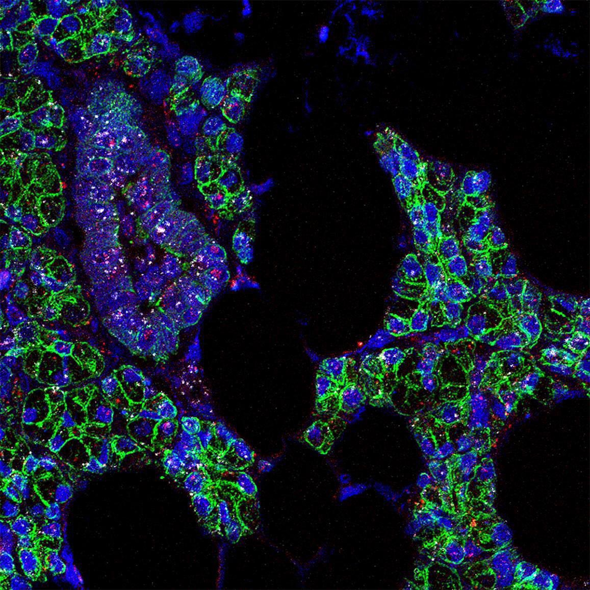 TheSTEMTimes's tweet photo. The last we had heard, SARS-CoV2 infected our lungs. But have you wondered why we lose our sense of taste during its infection? Read the latest post from TheSTEMTimes to know about a possible reasoning
https://t.co/54sAeeI5N8

#SARSCoV2 #salivaryglands #scicomm #thestemtimes https://t.co/r69n2w7hwx