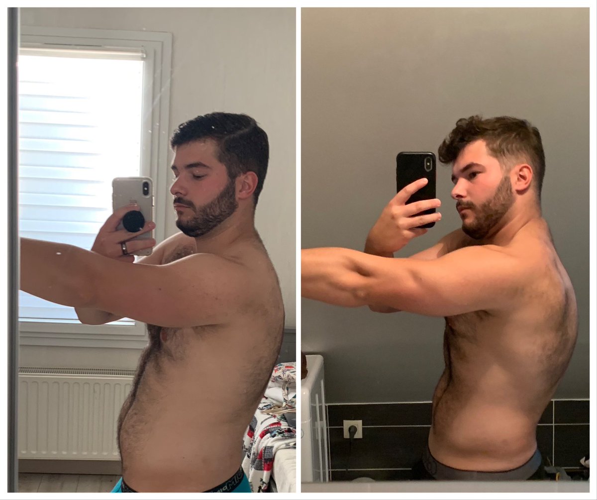 ScreaMy_Ex's tweet photo. Hi Twitter it’s been a while since I last post here ! 
I want to share my evolution of two months post injury from this summer (dislocated left shoulder).

Only the beginning 🔥 https://t.co/HxBG4VjWA0
