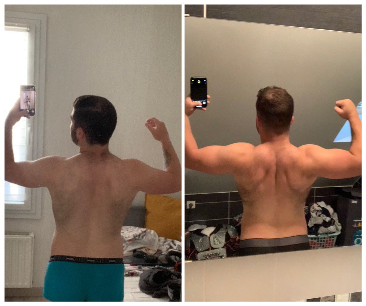 ScreaMy_Ex's tweet photo. Hi Twitter it’s been a while since I last post here ! 
I want to share my evolution of two months post injury from this summer (dislocated left shoulder).

Only the beginning 🔥 https://t.co/HxBG4VjWA0