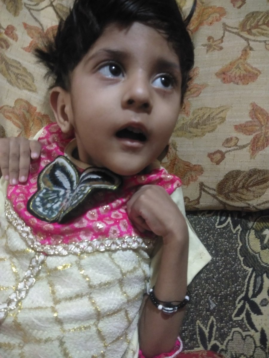 Rehna_7's tweet photo. بہت ہی غریب فیملی کی یہ معصوم بچی جو معمولی سی بیماری کے بعد مناسب علاج نہ ہونے کی وجہ سے معذور ہوگئی ہےاسکی نگاہیں اب کسی مسیحا کی منتظر ہیں آپ سے درخواست کرتی ہوں اس بچی کا ممکنہ علاج کروا کے اسکی ذندگی آسان بنا دیں
@Malikzaheerabas 
@PakBaitulMal 
@ImranKhanPTI https://t.co/oN94992wIb