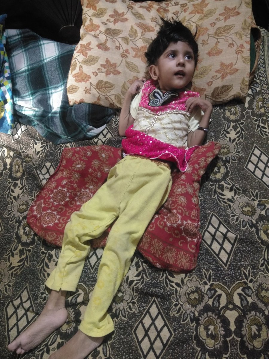 Rehna_7's tweet photo. بہت ہی غریب فیملی کی یہ معصوم بچی جو معمولی سی بیماری کے بعد مناسب علاج نہ ہونے کی وجہ سے معذور ہوگئی ہےاسکی نگاہیں اب کسی مسیحا کی منتظر ہیں آپ سے درخواست کرتی ہوں اس بچی کا ممکنہ علاج کروا کے اسکی ذندگی آسان بنا دیں
@Malikzaheerabas 
@PakBaitulMal 
@ImranKhanPTI https://t.co/oN94992wIb
