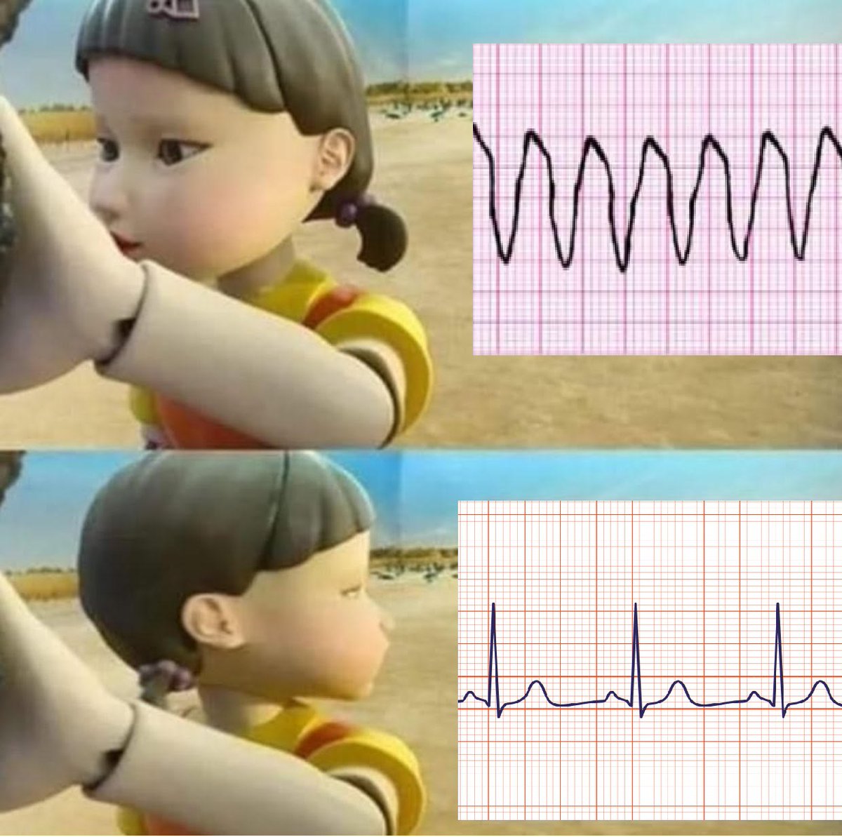 if you know you know