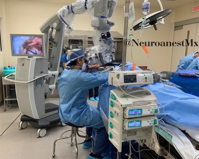 NeuroanestMx's tweet photo. #microvasculardecompression
Male 34 years old. Trigeminal neuralgia V1, right V2.
#tiva Propo-Remi-Lido, #type II monitoring.
Neuromonitoring #bismonitor
Position: Left #parkbench
#neuroanesthesia
#neurosurgery
#teamtiva
#neurotwitter
#medtwitter https://t.co/x10LIiZRR0