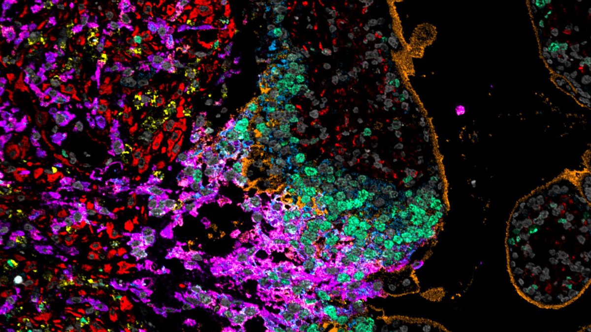 NIH_CommonFund's tweet photo. Ever wonder how the uterus makes blood vessels to nourish a fetus? So do @_hubmap researchers from @stanford's Angelo Lab! They built an atlas of the maternal-fetal interface to find out. Come see what develops! https://t.co/PptB5l1D6t #MIBI #MIBITOF #multiplexedimaging https://t.co/viUJnbg5OP