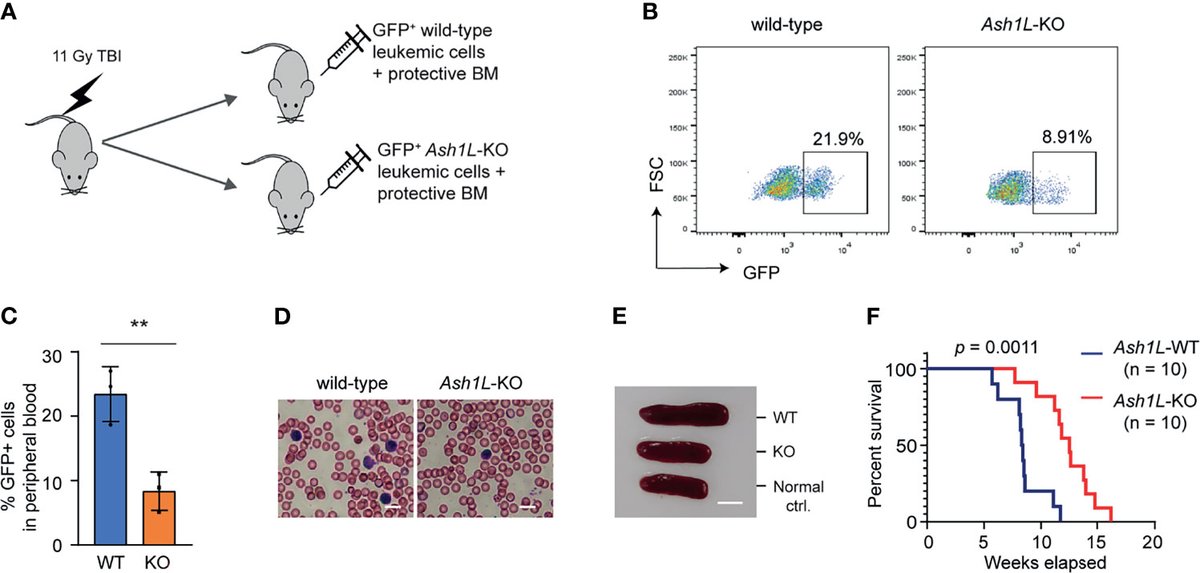 JinHeLab_MSU's tweet photo. Excited for having our MS out: A critical role of epigenetic factor ASH1L in leukemia development, providing a new therapeutic target to treat human blood cancer. @georgemias @MSU_BMB https://t.co/nWMH5TgEpv