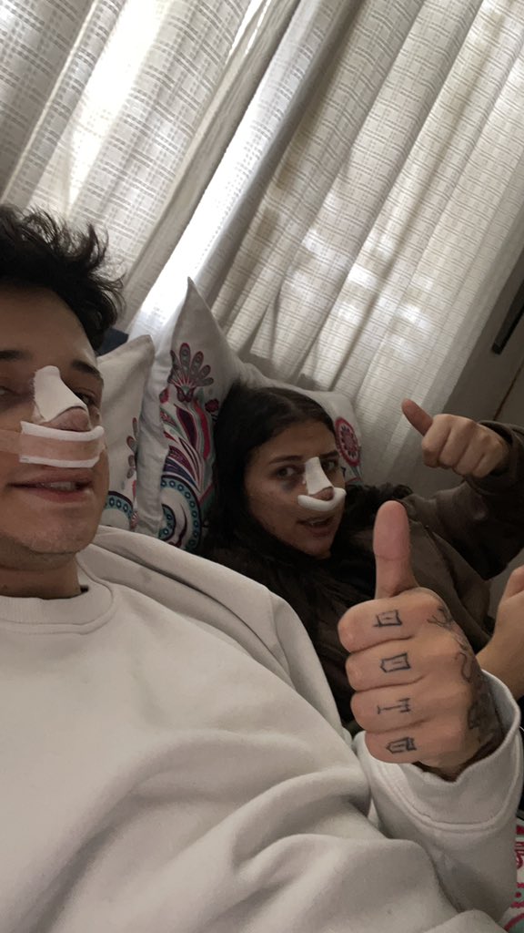 padecirnosotros's tweet photo. "mi novia y yo nos hicimos la rino juntos" https://t.co/9HzHHhjzxk