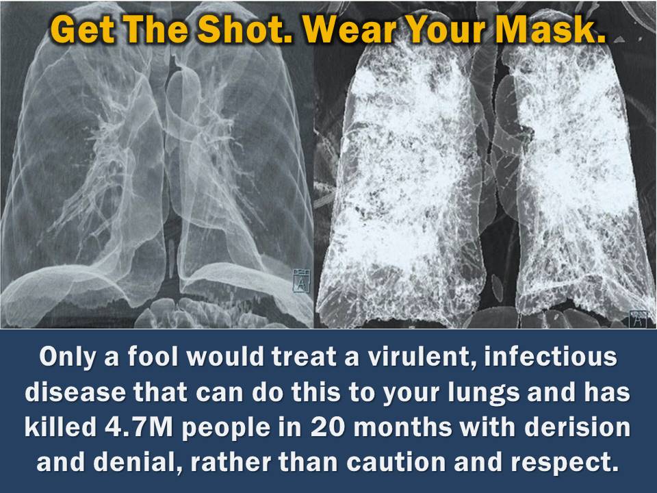 RClinto57113970's tweet photo. @davidmweissman I used to be a respiratory therapist in the ICU of a major Boston academic medical center. Over a dozen years, I've seen what viral pneumonias and ARDS (Google it) can do to the human lungs, both at the bedside and at autopsy.
That's why I got vaccinated. https://t.co/W1ULE5Lx3L