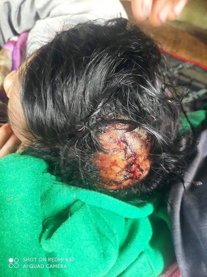 hannayuri_twt's tweet photo. Two pro-military men with guns beat the guards &amp; set fire to water treatment plant at the Eternal Swimming Pool and Resort in Thitya Myaing Ward, Kyunhla township at around 12 midnight on October 8.

#WeSupportNUG
#Oct9Coup
#WhatsHappeningInMyanmar
tw // wound https://t.co/9DiVMnMMO5