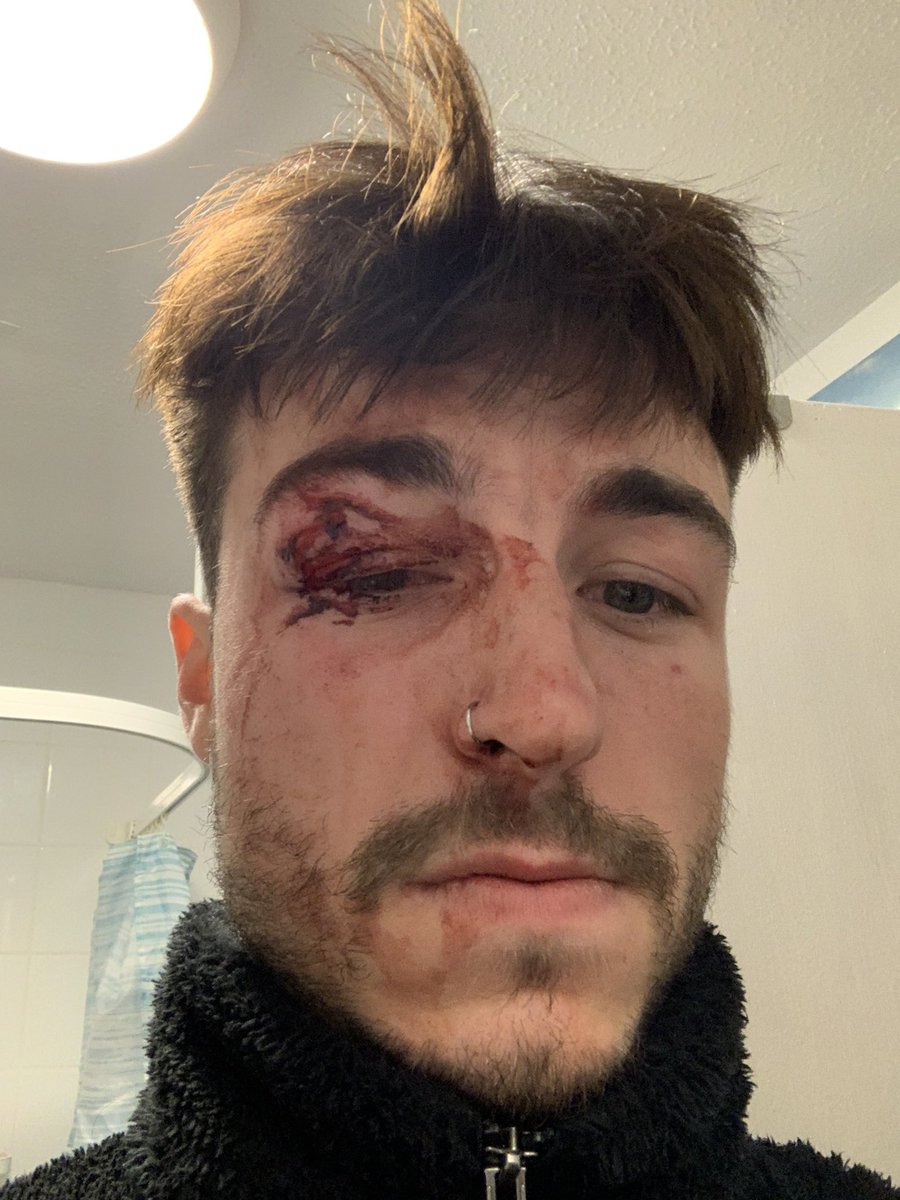 kanewarren's tweet photo. @cale_hood @Leadmill ill be taking legal action after your bouncers kicked my head in whilst i was on the floor after being dragged off the stage (that plenty of people were on) you horrible establishment. my favourite place to go in sheffield and now i’ll make sure i never step foot in again https://t.co/xJLSRLk16B
