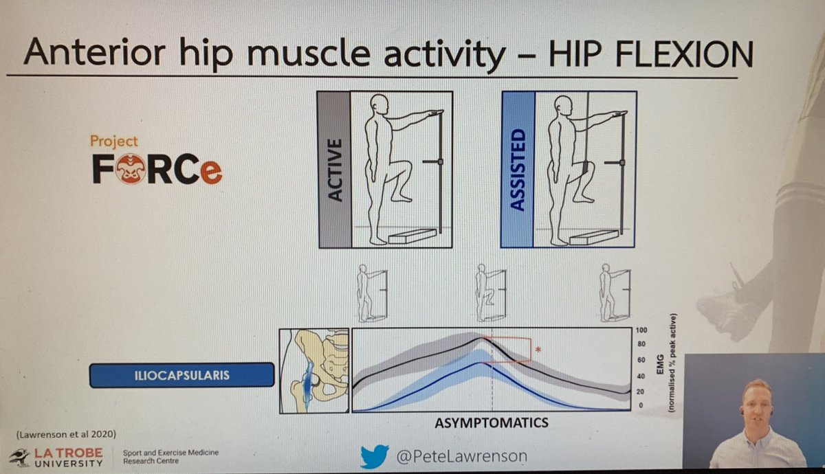 <a href="/PeteLawrenson/">Peter Lawrenson</a> presenting this am at #SMAeConf21 fw-emg study showing that those with FAIS demonstrate changes in iliocapsularis activity during an assisted hip flexion task. Increase in active capsular tensioning may suggest a protective mechanism to reduce impingement. #fais