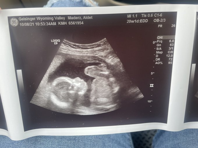 Our beautiful baby girl! 😍 She&rsquo;s perfect! ❤️ https://t.co/G4yyHYmOaB<a href="/tag/scamawareness"class="tags"><span>#scamawareness</span></a>