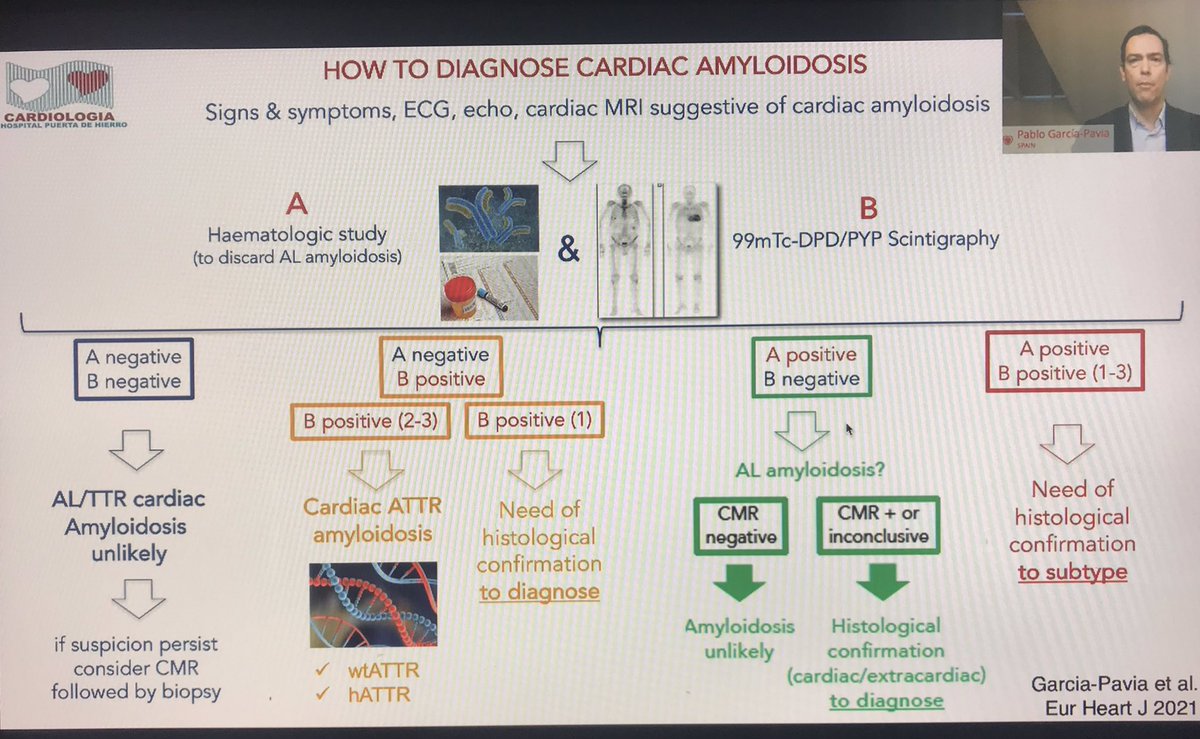 mdlaledinc's tweet photo. ESC myocardial and pericardial disease 2021 meeting has just started. Easy way of not to fotget this diagnostic algorithm of cardiac amyloidosis from @dr_pavia . @SilCastelletti @AntoniPantazis @saramoscatelli7 @PeroneFrancesco @uygurbegum_ @gamzebaburguler @drzgezdentok1 https://t.co/w20g4GSQsX