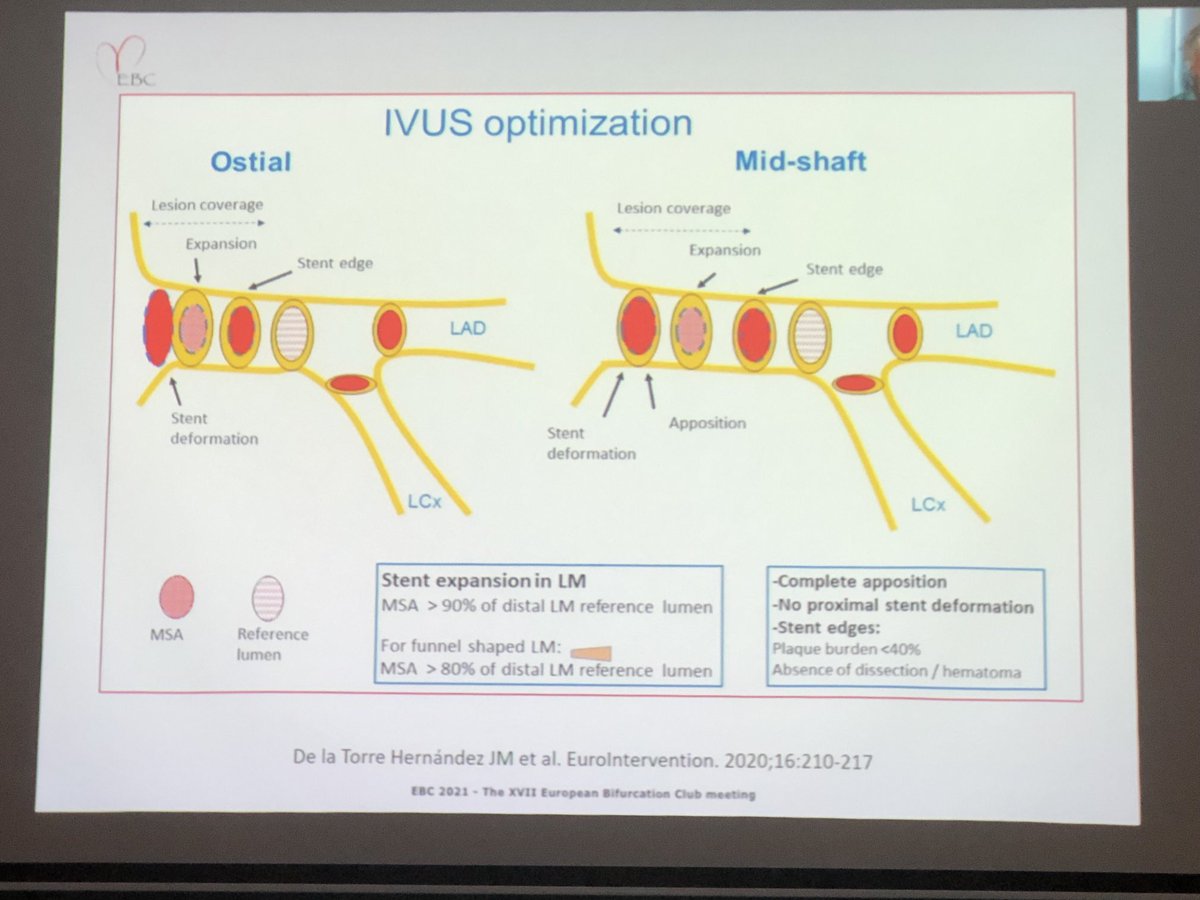 stefan_harb's tweet photo. #IVUS goals for #LMPCI 

Jose de laTorre Hernandez https://t.co/27fmZ7q5z9