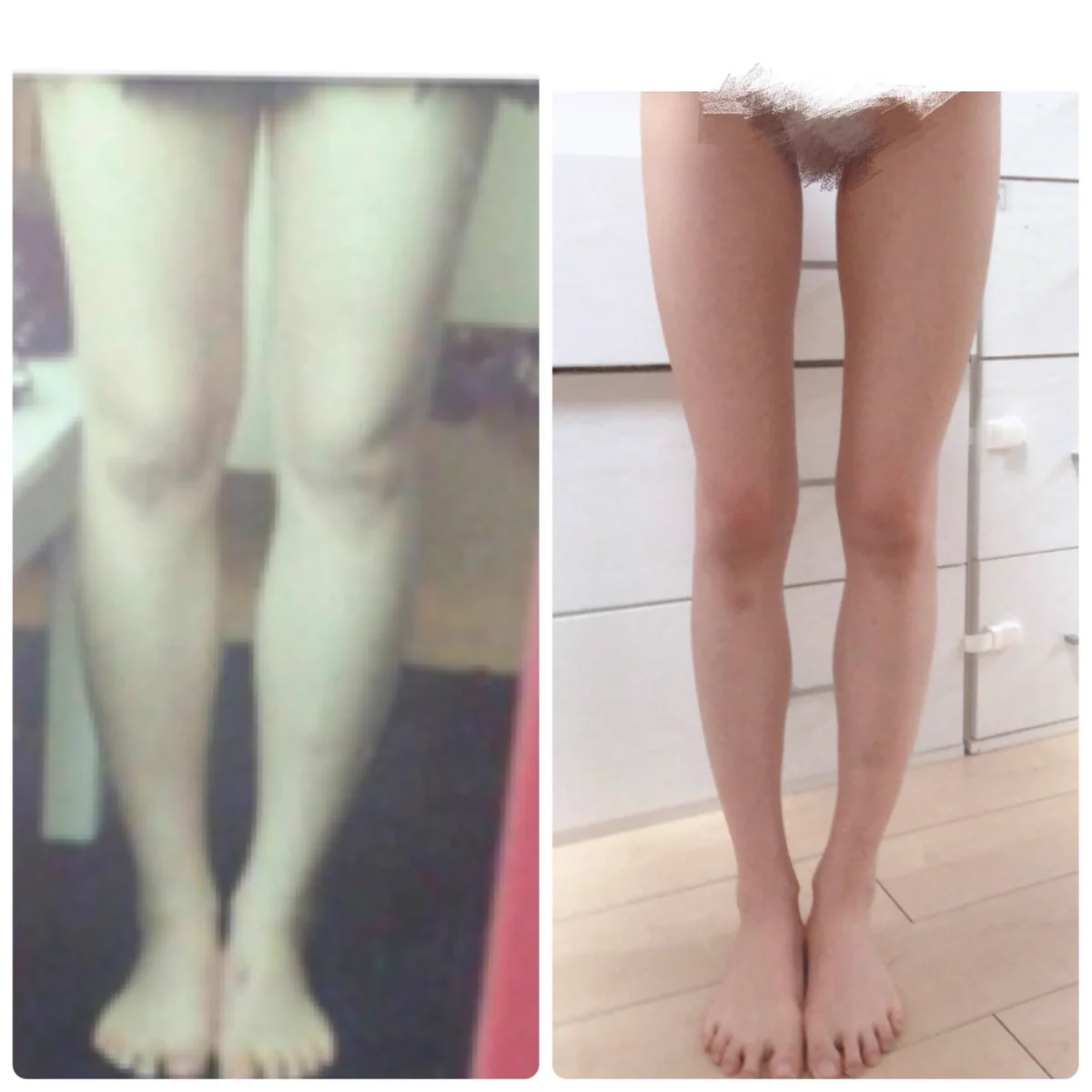 ふとももが太い。美脚を目指したい方。昔の私みたいな脚の人はとりあえずこれ使ってストレッチがおすすめ