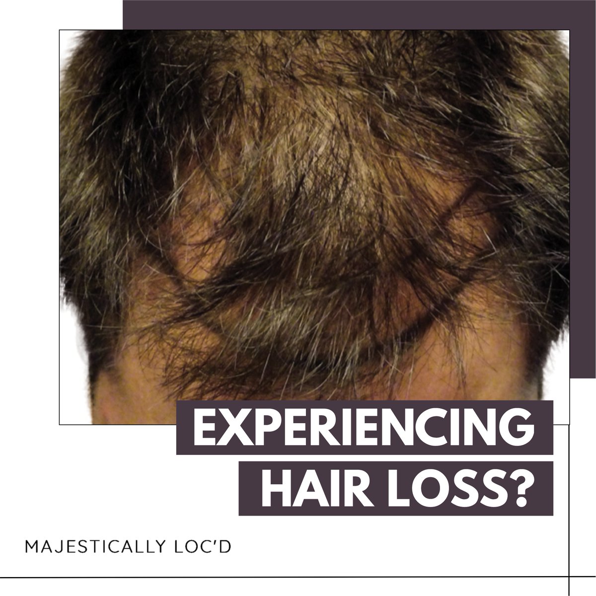 Are you experiencing hair loss? Dry or extremely damaged hair? Light to intense dandruff? Excessive oil production causing greasy hair and scalp?
.
#majesticallylocd #hairrestoration #latesthairstyles #trendyhairstyles #enhanceyourouterbeauty #hairlossconsultation #cornrows