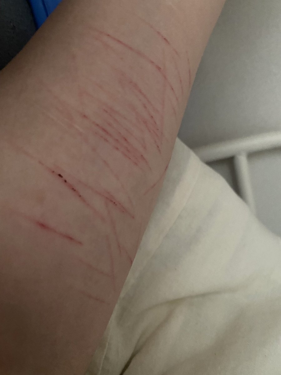 undermydress2's tweet photo. #self_harm https://t.co/slRBp1oY3E