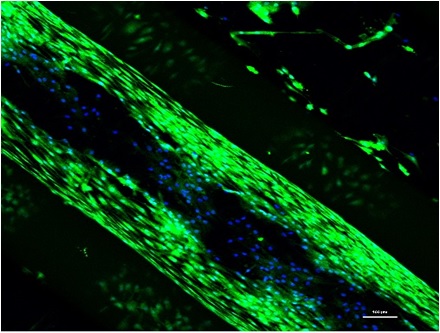 josbaema's tweet image. 📢💙🧫 Chondrocytes characterization 🧬🔬

lnkd.in/d3JFdnxX

🔬🧬A method found in labmethods.org 🧬🔬

#Biofabrication #Labmethods #Cartilage #Bioprinting #chondrocytes