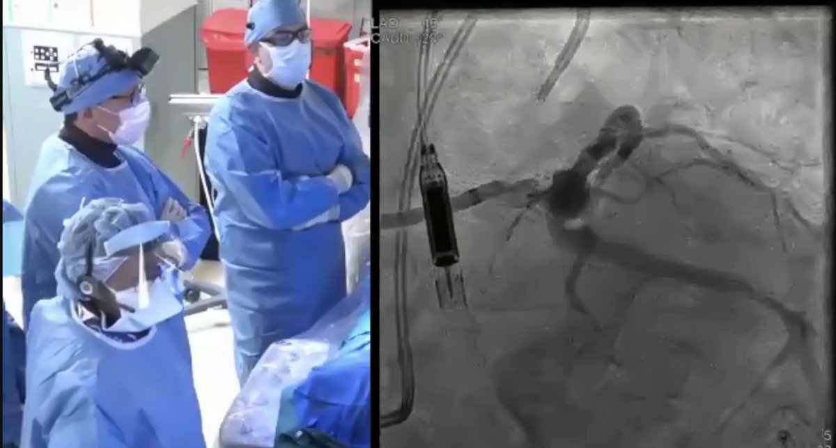 mirvatalasnag's tweet image. How would you approach this? 😱
@CRT_meeting #CRTVirtual #MastersCourse
@ron_waksman @djc795 @drptca