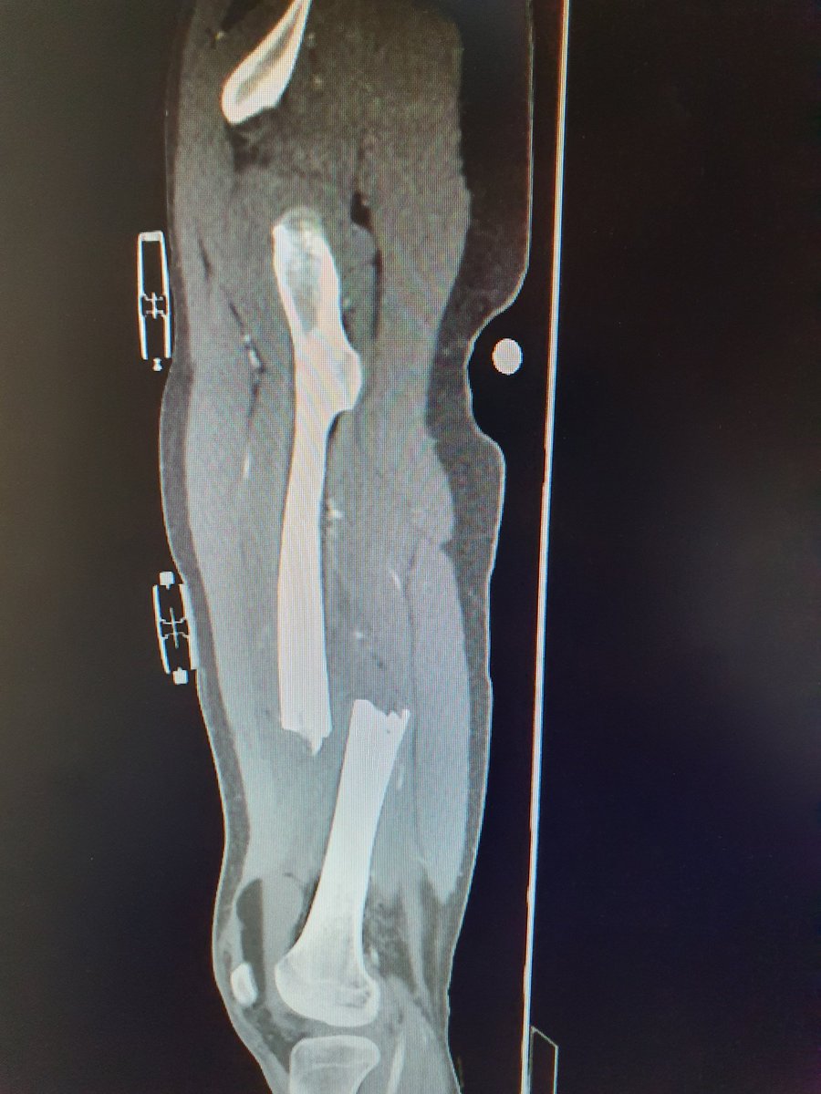 Lepetitmanip tweet media