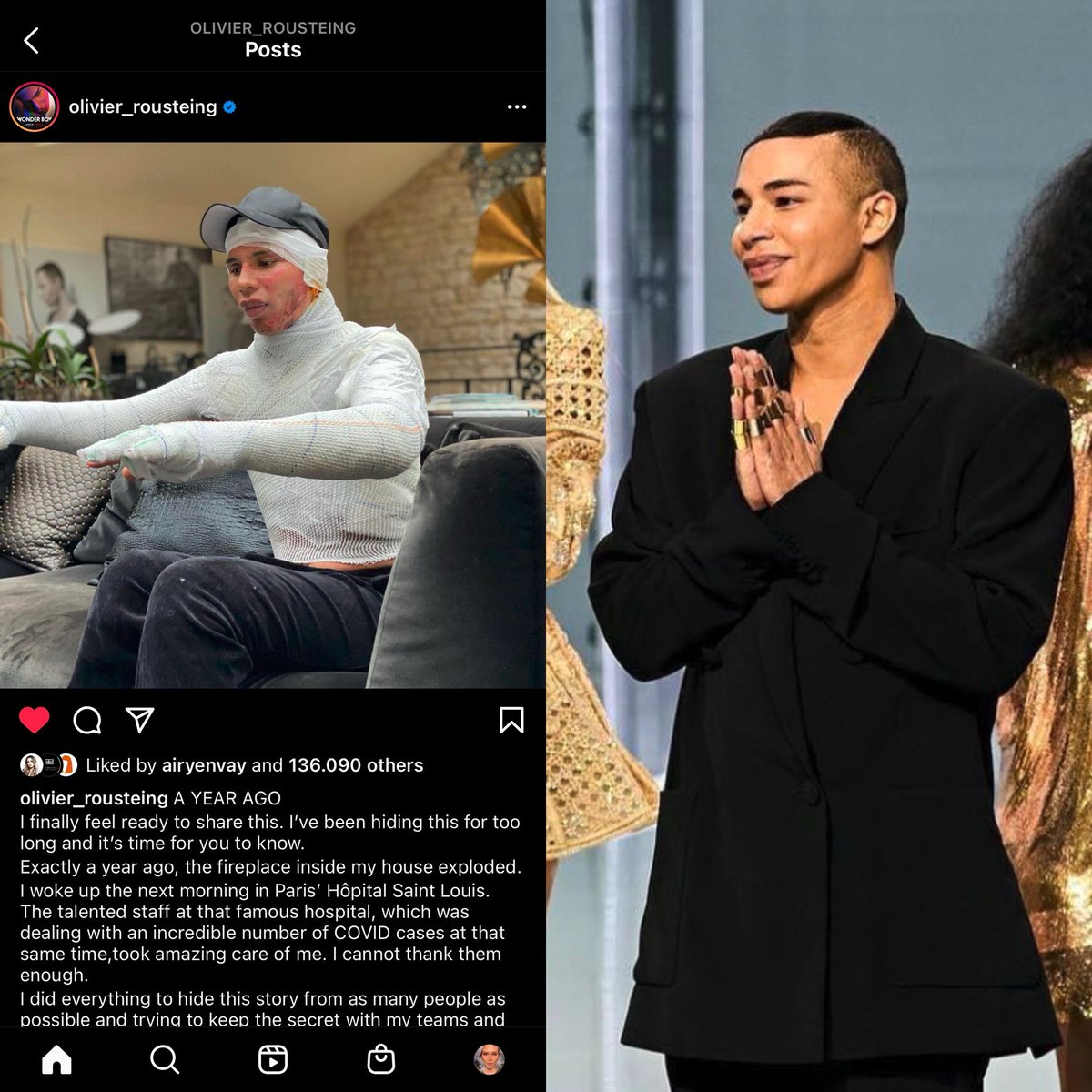 Edvigia's tweet photo. What it means to be a millionaire #burnvictim survivor. Left 1 year ago, right, last week. The medical technology exists.
#OlivierRousteing - creative director of #Balmain
#richprivilege https://t.co/8kw1nKXlRE