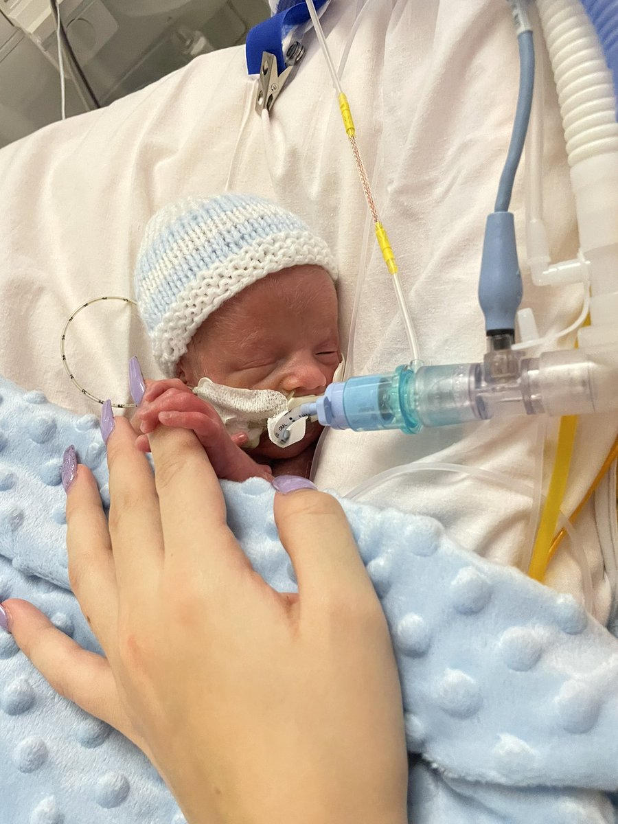 JadeEaraker's tweet photo. After 5 long days; we finally held you. 
There’s no feeling like it 😭 the most emotional and rewarding experience. 
I love you Zachary. https://t.co/iZHSomnFiJ
