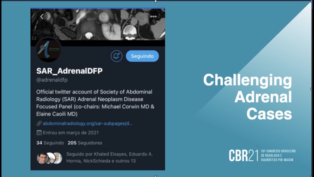 Fernando Ide Yamauchi (@nandoide) on Twitter photo tomorrow will be discussing challenging adrenal cases at <a href="/CBRadiologia/">CBR</a>. Lots of citation to <a href="/NickSchiedaMD/">NickSchieda</a> <a href="/ElsayesKhaled/">Khaled Elsayes</a> <a href="/ErickMRemer/">Erick Remer</a> and <a href="/adrenaldfp/">SAR_AdrenalDFP</a> ! Thanks <a href="/mauzappa/">Mauricio Zapparoli, MD MSc</a> for the invite tomorrow will be discussing challenging adrenal cases at <a href="/CBRadiologia/">CBR</a>. Lots of citation to <a href="/NickSchiedaMD/">NickSchieda</a> <a href="/ElsayesKhaled/">Khaled Elsayes</a> <a href="/ErickMRemer/">Erick Remer</a> and <a href="/adrenaldfp/">SAR_AdrenalDFP</a> ! Thanks <a href="/mauzappa/">Mauricio Zapparoli, MD MSc</a> for the invite