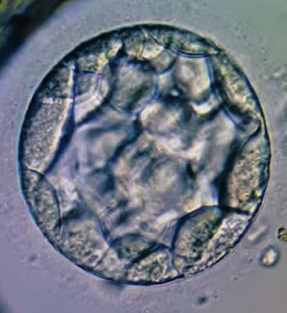 faizal_obgyn's tweet photo. Kualiti embrio adalah sgt penting bg menentukan kejayaan IVF. Gred embrio sgt mempengaruhi kebolehlekatan embabies. Sekiranya kualiti terjejas, pekembangan embrio didalam rahim jugak agak terbatas dan sering mengakibatkan keguguran. #embryo #ttc #embryoquality https://t.co/gE3kYxz6Fw