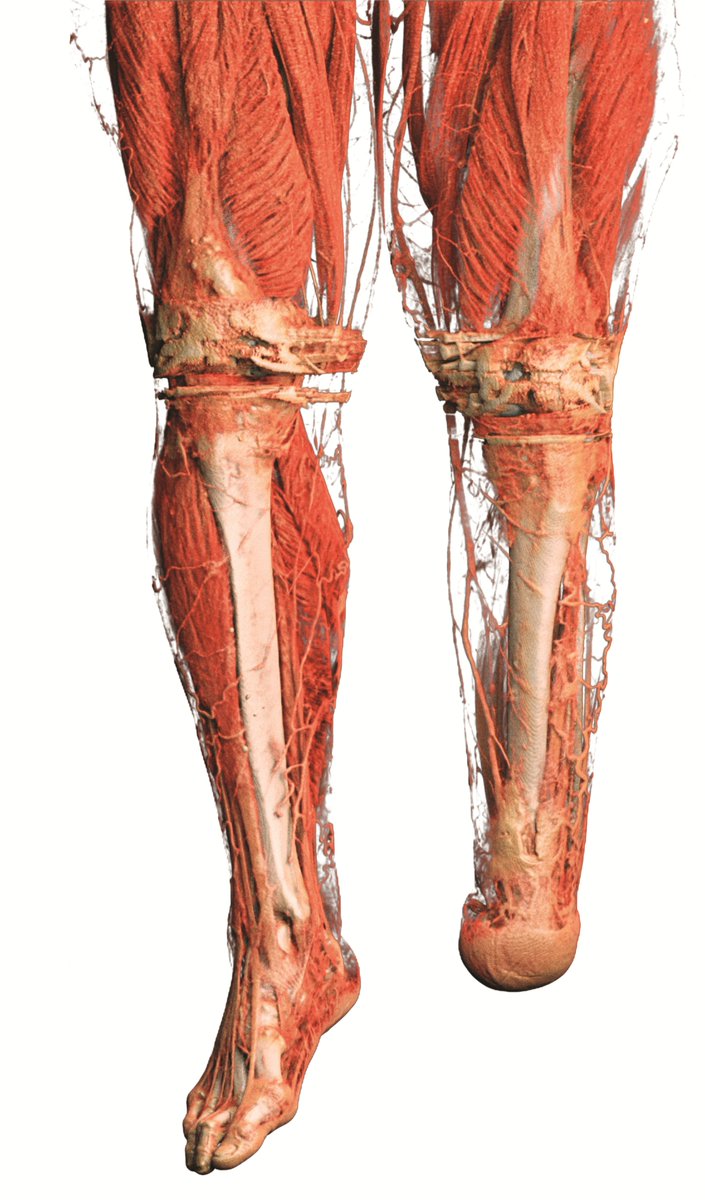 Anatomage's tweet photo. When life is visualized
#VisualizeLife #anatomy #anatomyart https://t.co/mxEdAQjvY5
