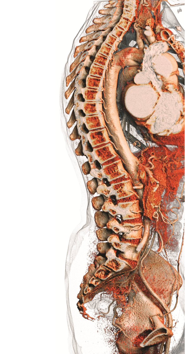Anatomage's tweet photo. When life is visualized
#VisualizeLife #anatomy #anatomyart https://t.co/mxEdAQjvY5