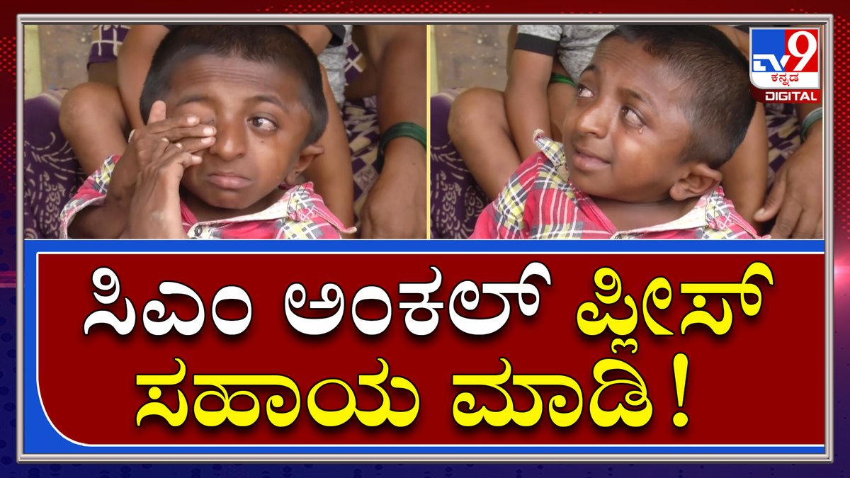 tv9kannada's tweet photo. Chabbi ಗ್ರಾಮದಲ್ಲಿದ್ದಾರೆ 30ಕ್ಕೂ ಅಧಿಕ ವಿಶೇಷಚೇತನರು, ಕುಬ್ಜರು|Bagalakote|Tv9Kannada
Video Link►https://t.co/OTR9lHJu9u
#TV9Kannada #PhysicallyChallenge #PhysicallyDisable #Kubjaru #Crying #Feeling #BagalakoteDistrict #DistrictOfficers #BasavarajaBommai #KarnatakaCM https://t.co/CGzf7kHKhd