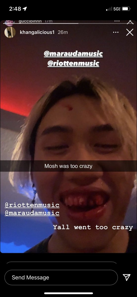 dnguyen177's tweet photo. mosh went to hard for the homie
@RiotTenMusic 
@maraudamusic https://t.co/RN8Gbg3fjC