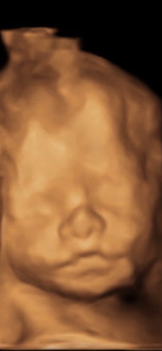 addie937's tweet photo. Love comparing lol he has my baby nose 💙 https://t.co/g2BXdHFx1Q