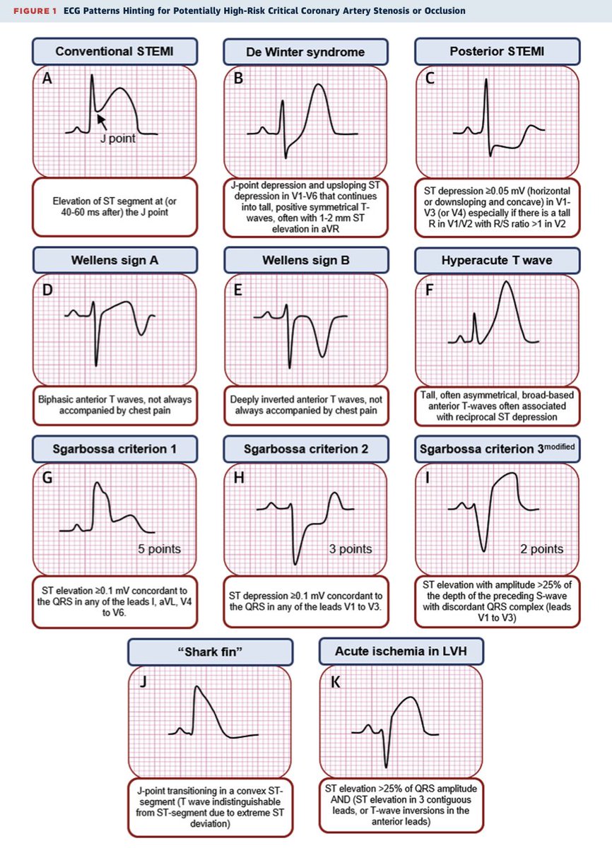 ⚠️ Cool summarizing pic of potentially high-risk ECG patterns !
DOI: 10.1016/j.jaccas.2019.10.030
<a href="/WondrMedical/">Wondr Medical</a>