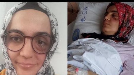 PatrickJane02's tweet photo. Hukuksuzluk bu ülkenin kaderi değil!

4. evre kanser hastası Ayşe Özdoğan 2. defa cezaevine/ölüme gönderildi. Bu twiti gören vicdanlı, yüreği güzel tüm hesaplardan rica ediyorum.

Lütfen siz de iki arkadaşınızı etiketleyip #AyşeÖzdoğanaÖzgürlük der misiniz?

@FilizKer @MelekCetk https://t.co/ToD5dWIJHK