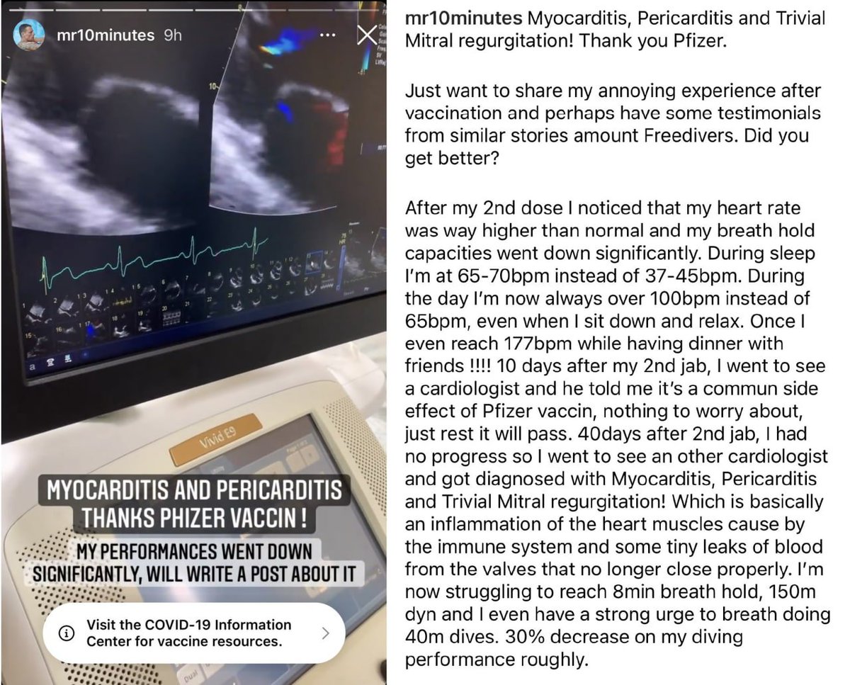 KeaneaJane's tweet photo. Florian Dagoury, the current world's top static breath-hold freediver - he officially held his breath for 10 minutes and 30 seconds - has been diagnosed with myocarditis and pericarditis 40 days after his second dose with the Pfizer vaccine https://t.co/W6yQ51E9EW
