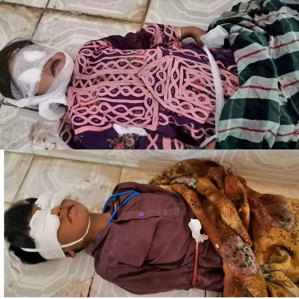 MahrangBaloch_'s tweet photo. It’s brutal form of genocide, even our children are not safe from the hands of security forces.There is no laws, constitution, &amp; judiciary to stop and make accountable security forces. While Int HR Orgs have kept their criminally silence on Baloch genocide.
#StopBalochGenocide https://t.co/KWhuWedWIJ