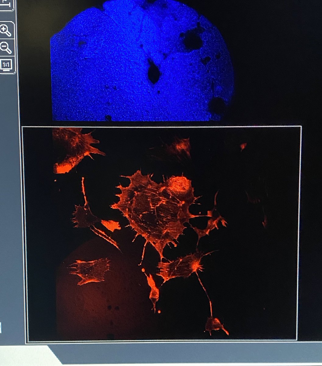 Podocyte Love! Finding inspiration under the microscope 🔬❤️ #Nephrology #NephTwitter #Womeninnephrology #MedTwitter