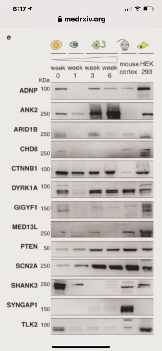 SynGAP Research Fund (SRF) (@curesyngap1) on Twitter photo Excited to see #syngap1 as one of the 13 proteins in this study. Along with other friends <a href="/ADNPkids/">ADNP kids</a> <a href="/ctnnb1org/">CTNNB1 Syndrome Awareness Worldwide</a> <a href="/OnceUponAGene/">Effie Parks</a> <a href="/PTENFoundation/">PTEN Foundation US</a> <a href="/MED13L_UPDATE/">MED13L_UPDATE</a> <a href="/CureSHANK/">CureSHANK</a> <a href="/krispmelb/">Kris Pierce</a> <a href="/combined_brain/">COMBINEDBrain</a> Excited to see #syngap1 as one of the 13 proteins in this study. Along with other friends <a href="/ADNPkids/">ADNP kids</a> <a href="/ctnnb1org/">CTNNB1 Syndrome Awareness Worldwide</a> <a href="/OnceUponAGene/">Effie Parks</a> <a href="/PTENFoundation/">PTEN Foundation US</a> <a href="/MED13L_UPDATE/">MED13L_UPDATE</a> <a href="/CureSHANK/">CureSHANK</a> <a href="/krispmelb/">Kris Pierce</a> <a href="/combined_brain/">COMBINEDBrain</a>