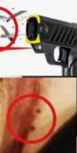 yogazyr's tweet photo. Sushant was found with -

▪︎Fractured leg
▪︎Cuts &amp; bruises on body 
▪︎Stun gun &amp; needle marks on neck 
▪︎O-shaped ligature 
▪︎Face paralysed

No suicide note found nor did anyone see the body hanging.

Isn't this a murder? @ips_nupurprasad

CBI Y No IPC 302 In SSR Case https://t.co/J6NGaBSEC8