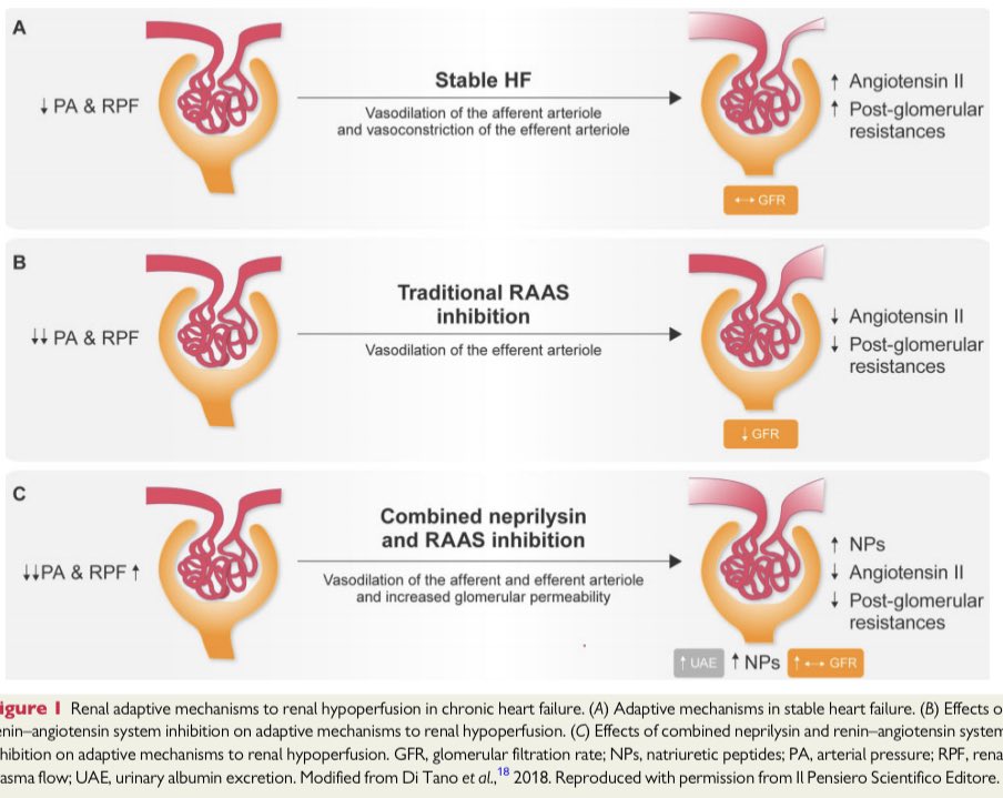 GiuseppeGalati_'s tweet photo. 👆 #RenalProtection of #ARNI in #HeartFailure @nephondemand @JavedButler1 @DrNasrien @gcfmd @JJheart_doc @HeartOTXHeartMD @markcpetrie20 @AnnaKateBarton @PSJhund @Dr_Manito @IC_LaFe @DrDEliaEmilia @novitskiynic @gabianfortes @DBelardoMD @MicheleSenni
https://t.co/4sQW4y4fUf https://t.co/lLwTWGK5nH