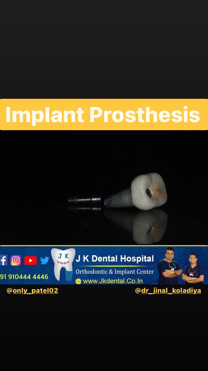 JKDENTALORTHO's tweet photo. Implant crown was inserted today at @JKDENTALORTHO , Ahmedabad by our skilled clinician @keval_r_patel .

Implant is the best alternative to replace the missing tooth.

#trending #covid #vaccine #dentist #orthodontist #ahmedabad #chandkheda #newcgroad https://t.co/xVqbd7Y1IR