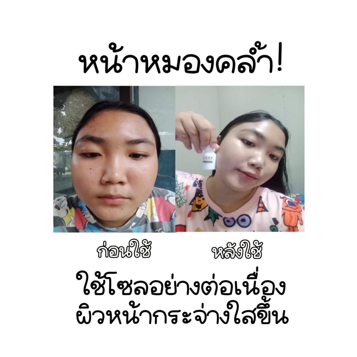 Pikk28423422's tweet photo. รีวิวดีต่อ💗💗
#เซรั่มโซล #เซรั่มออแกรนิค #เซรั่���ลดสิว #เซรั่มหน้าใส #หน้ากากอนามัย #หน้าแพ้แมส #เป็นสิว #ใช้ดีบอกต่อ #ใช้ดีบอกต่อสิว #ใช้เองรีวิวเอง #แคปชั่นเด็ด #แคปชั่นกวนตีน #แคปชั่นน่ารัก #แคปชั่นเสี่ยว #นัดรับ #แม่ค้าคนโสด #ของดีบอกต่อ #Serum #ขายของออนไลน์ https://t.co/YA1fmAv1uj